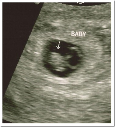 angel 2_8.5.11_6wks3days