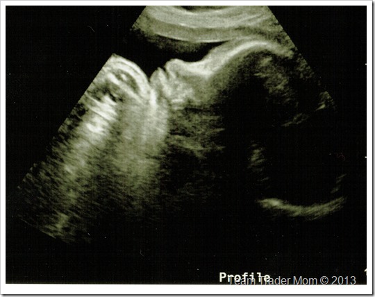 Profile_39wks_4.4.13